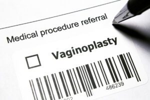 Vaginoplasty written on image