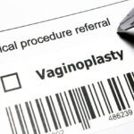 Vaginoplasty written on Medical Paper
